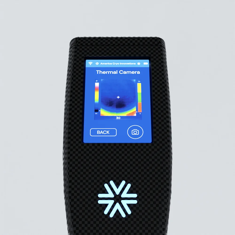 The XR ISO thermal camera view, live on the device screen