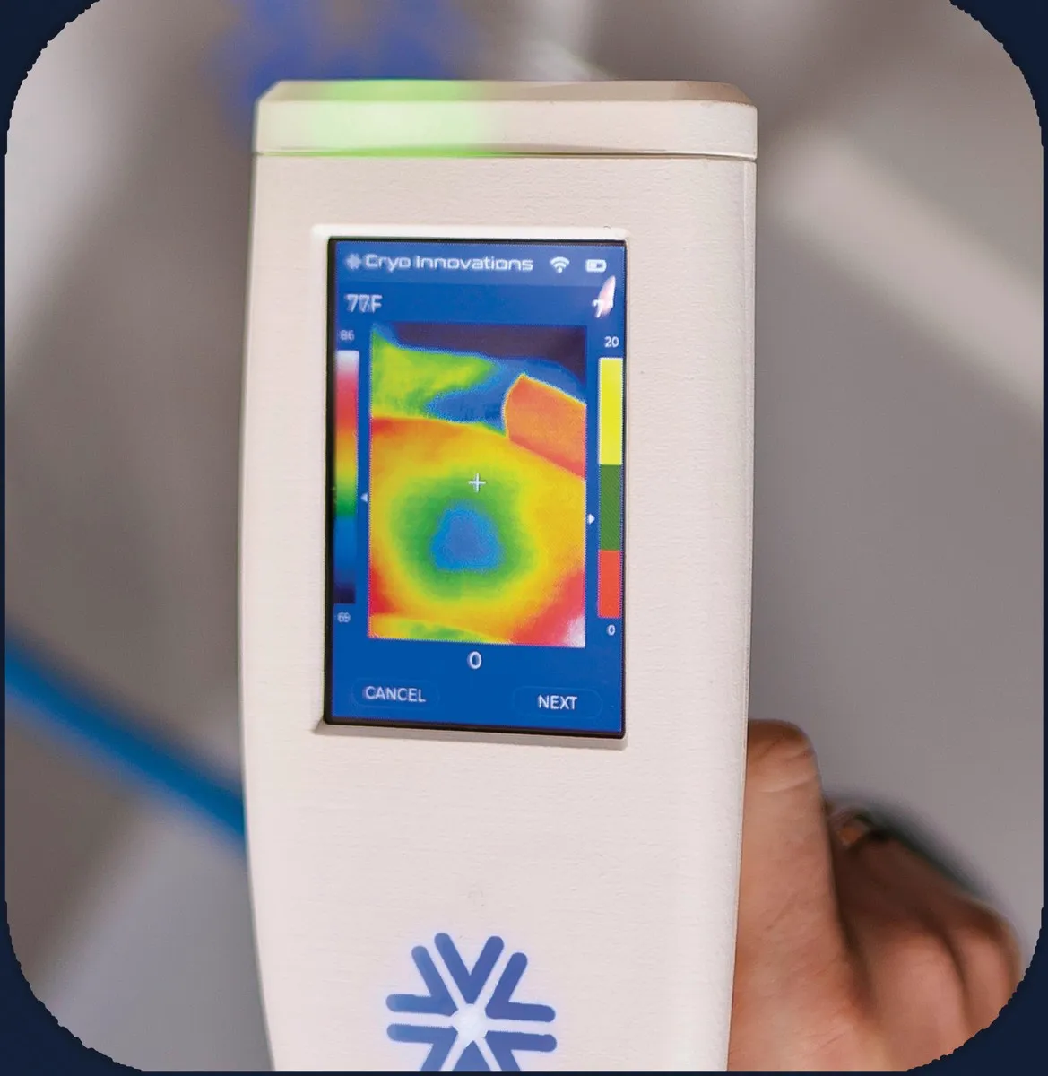 Thermal imaging readout on the XR ISO screen during a treatment